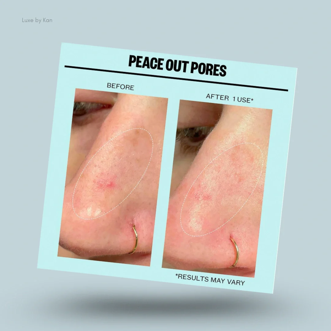 PEACE OUT DARK SPOTS - Image 3